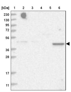 Invitrogen TRAPPC13 Polyclonal Antibody 100 &mu;L; Unconjugated:Antibodies,