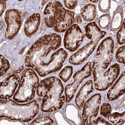 Invitrogen PSTK Polyclonal Antibody 100 &mu;L; Unconjugated:Antibodies,