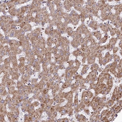 Invitrogen PSTK Polyclonal Antibody 100 &mu;L; Unconjugated:Antibodies,