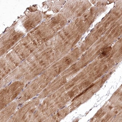 Invitrogen PSTK Polyclonal Antibody 100 &mu;L; Unconjugated:Antibodies,