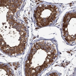 Invitrogen DYDC1 Polyclonal Antibody 100 &mu;L; Unconjugated:Antibodies,