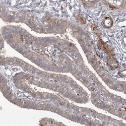 Invitrogen KBTBD4 Polyclonal Antibody 100 &mu;L; Unconjugated:Antibodies,