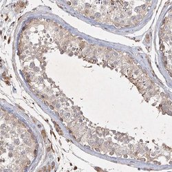 Invitrogen KBTBD4 Polyclonal Antibody 100 &mu;L; Unconjugated:Antibodies,