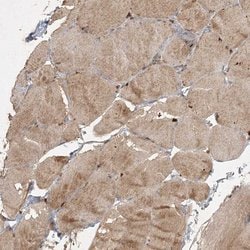 Invitrogen KBTBD4 Polyclonal Antibody 100 &mu;L; Unconjugated:Antibodies,
