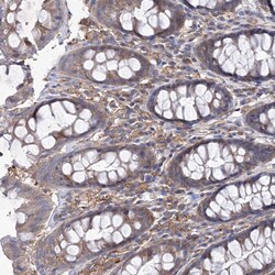 Invitrogen SNX18 Polyclonal Antibody 100 &mu;L; Unconjugated:Antibodies,