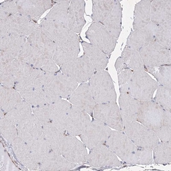 Invitrogen SNX18 Polyclonal Antibody 100 &mu;L; Unconjugated:Antibodies,
