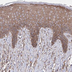 Invitrogen SNX18 Polyclonal Antibody 100 &mu;L; Unconjugated:Antibodies,