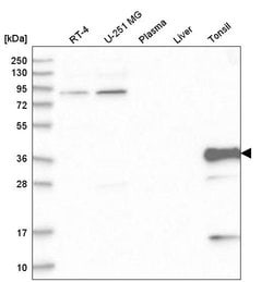 Invitrogen TNNT3 Polyclonal Antibody 100 &mu;L; Unconjugated:Antibodies,