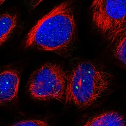 Invitrogen NAT11 Polyclonal Antibody 100 &mu;L; Unconjugated:Antibodies,