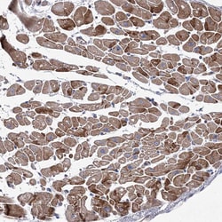 Invitrogen NAT11 Polyclonal Antibody 100 &mu;L; Unconjugated:Antibodies,
