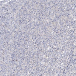 Invitrogen NAT11 Polyclonal Antibody 100 &mu;L; Unconjugated:Antibodies,