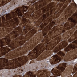 Invitrogen NAT11 Polyclonal Antibody 100 &mu;L; Unconjugated:Antibodies,