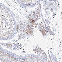 Invitrogen NAT11 Polyclonal Antibody 100 &mu;L; Unconjugated:Antibodies,