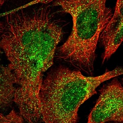 Invitrogen DEPP Polyclonal Antibody 100 &mu;L; Unconjugated:Antibodies,