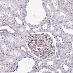 Invitrogen DEPP Polyclonal Antibody 100 &mu;L; Unconjugated:Antibodies,