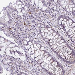 Invitrogen DEPP Polyclonal Antibody 100 &mu;L; Unconjugated:Antibodies,