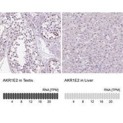 Invitrogen AKR1E2 Polyclonal Antibody 100 &mu;L; Unconjugated:Antibodies,