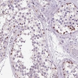 Invitrogen AKR1E2 Polyclonal Antibody 100 &mu;L; Unconjugated:Antibodies,