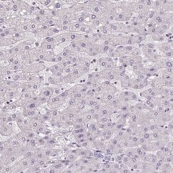 Invitrogen AKR1E2 Polyclonal Antibody 100 &mu;L; Unconjugated:Antibodies,
