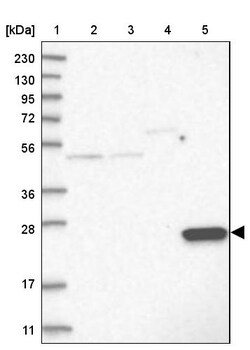 Invitrogen AKR1E2 Polyclonal Antibody 100 &mu;L; Unconjugated:Antibodies,