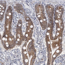 Invitrogen MTG1 Polyclonal Antibody 100 &mu;L; Unconjugated:Antibodies,