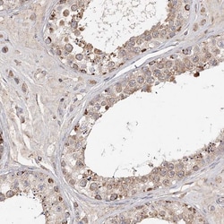 Invitrogen CDC123 Polyclonal Antibody 100 &mu;L; Unconjugated:Antibodies,