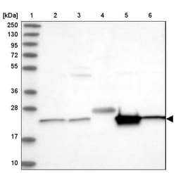 Invitrogen CDC123 Polyclonal Antibody 100 &mu;L; Unconjugated:Antibodies,