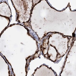 Invitrogen AFAP1L2 Polyclonal Antibody 100 &mu;L; Unconjugated:Antibodies,