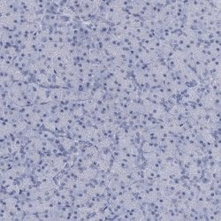 Invitrogen HORMAD1 Polyclonal Antibody 100 &mu;L; Unconjugated:Antibodies,