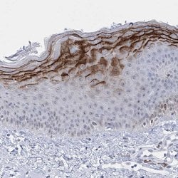 Invitrogen HORMAD1 Polyclonal Antibody 100 &mu;L; Unconjugated:Antibodies,
