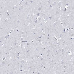Invitrogen HORMAD1 Polyclonal Antibody 100 &mu;L; Unconjugated:Antibodies,
