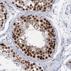 Invitrogen HORMAD1 Polyclonal Antibody 100 &mu;L; Unconjugated:Antibodies,