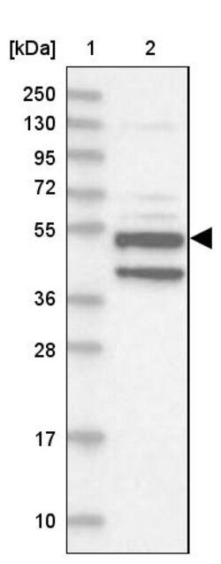 Invitrogen XYLB Polyclonal Antibody 100 &mu;L; Unconjugated:Anticuerpos