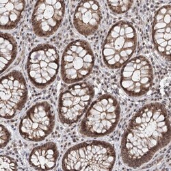 Invitrogen FAM13C Polyclonal Antibody 100 &mu;L; Unconjugated:Antibodies,