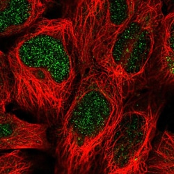 SIMC1 Polyclonal Antibody:Antibodies, Polyclonal