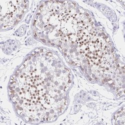 Invitrogen FAM170A Polyclonal Antibody 100 &mu;L; Unconjugated:Antibodies,