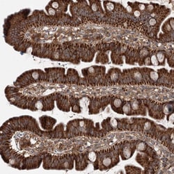 Invitrogen SKI3 Polyclonal Antibody 100 &mu;L; Unconjugated:Antibodies,
