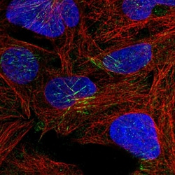 Invitrogen TRUB1 Polyclonal Antibody 100 &mu;L; Unconjugated:Antibodies,