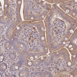Invitrogen TRUB1 Polyclonal Antibody 100 &mu;L; Unconjugated:Antibodies,