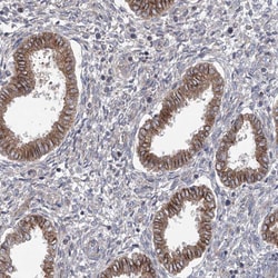 Invitrogen TRUB1 Polyclonal Antibody 100 &mu;L; Unconjugated:Antibodies,