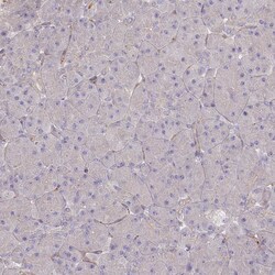Invitrogen TRUB1 Polyclonal Antibody 100 &mu;L; Unconjugated:Antibodies,