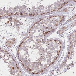 Invitrogen TRUB1 Polyclonal Antibody 100 &mu;L; Unconjugated:Antibodies,