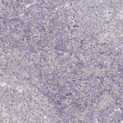 Invitrogen AAMDC Polyclonal Antibody 100 &mu;L; Unconjugated:Antibodies,