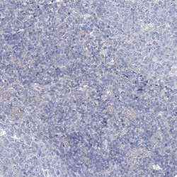 Invitrogen AAMDC Polyclonal Antibody 100 &mu;L | Buy Online | Invitrogen&trade; | Fisher Scientific