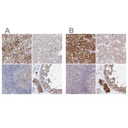 Invitrogen AAMDC Polyclonal Antibody 100 &mu;L | Buy Online | Invitrogen&trade; | Fisher Scientific