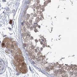 Invitrogen AAMDC Polyclonal Antibody 100 &mu;L | Buy Online | Invitrogen&trade; | Fisher Scientific