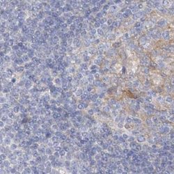 Invitrogen AAMDC Polyclonal Antibody 100 &mu;L | Buy Online | Invitrogen&trade; | Fisher Scientific