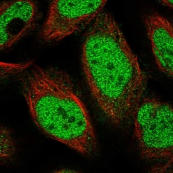 Invitrogen POLR3A Polyclonal Antibody 100 &mu;L; Unconjugated:Antibodies,