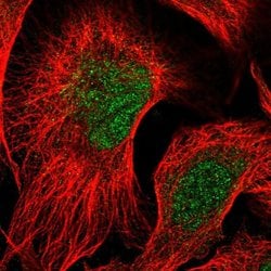 Invitrogen RTKN2 Polyclonal Antibody 100 &mu;L; Unconjugated:Antibodies,
