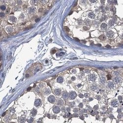 Invitrogen RTKN2 Polyclonal Antibody 100 &mu;L; Unconjugated:Antibodies,